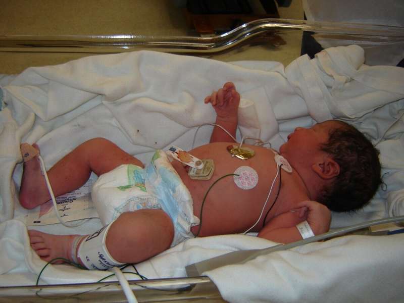The Perinatal Quality Collaborative of NC has been credited with reducing C-section births, boosting breastfeeding and cutting infection rates in the tiniest babies.