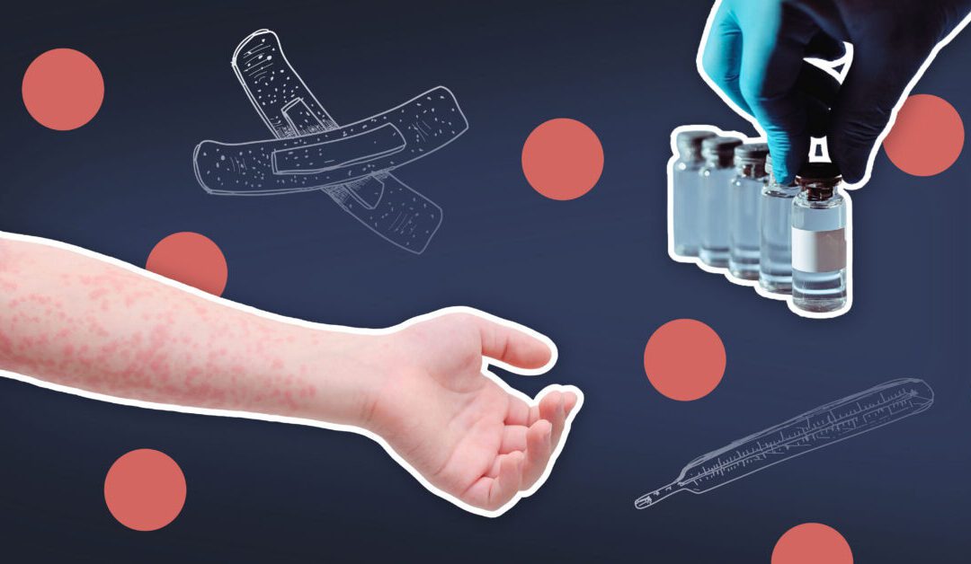 How measles came back from the dead and what it means for North Carolina