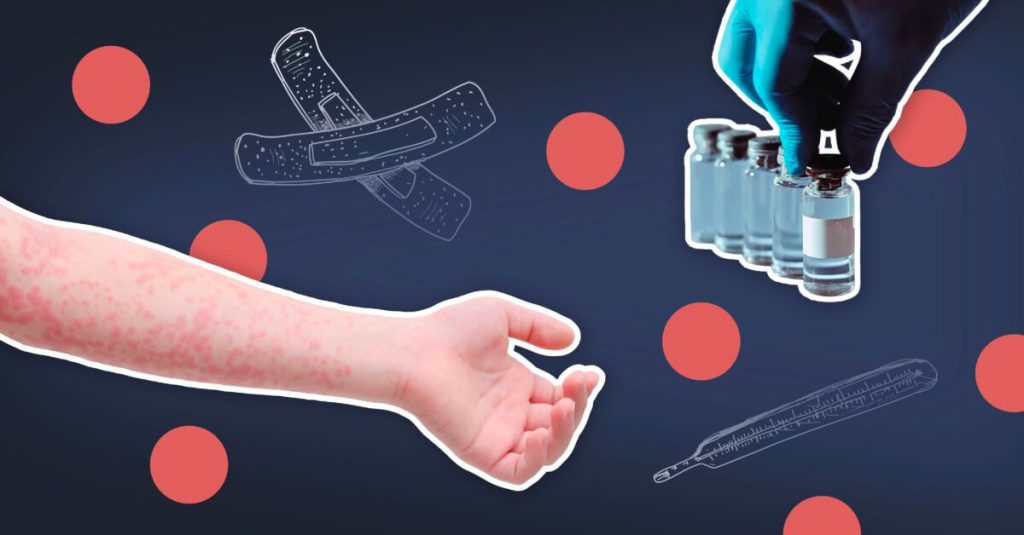 How measles came back from the dead and what it means for North Carolina